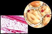 Fat cells,illustration