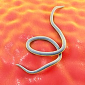 Threadworm,illustration