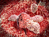 T-lymphocytes attacking a cancer cell