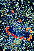 Coloured TEM of ribosomes translating MRNA strand