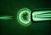 Light micrograph of cell showing DNA manipulation