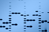 Autoradiograph of DNA