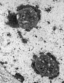 TEM of nucleoli in a mouse liver cell