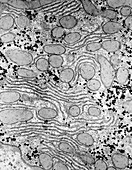 TEM of glycogen in Salamander liver cell