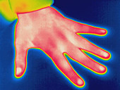 Thermogram of hand
