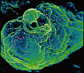HIV infected T-cell
