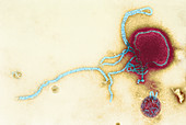 Parainfluenza virus