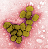 Smallpox viruses