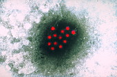 Hepatitis A virus,TEM