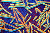 False-colour TEM of Tobacco Mosaic Virus