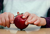Person with arthritic hands peeling an apple