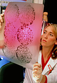 Biochemist studies autoradiograph in cancer lab