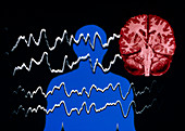 Artwork of epilepsy: brain and EEG traces