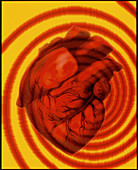 Artwork representing a heart attack