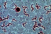 LM of blood infected with parasitic protozoans