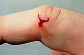 Close-up of a small cut on a finger