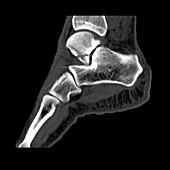 Computer Reconstruction of the Ankle