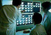 Doctors confer over MRI scans of a brain tumour