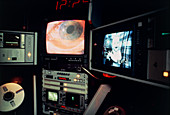 Eye operation shown on tv monitors in op. theatre