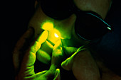 Close-up of laser used in cosmetic surgery
