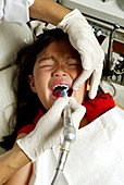 Teeth Cleaning