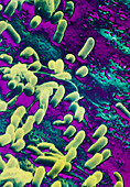 Flase-colour SEM of bacteria on surface of a tooth