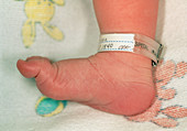 Hospital identification tag on newborn baby's foot