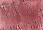 Interdigitation of actin and myosin filaments