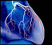 False-colour X-ray of normal heart