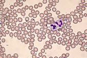 Human blood smear