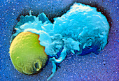 F/col SEM of lymphocyte phagocytosing a yeast cell