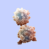 Lymphocytes Undergoing Apoptosis