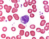 Monocyte