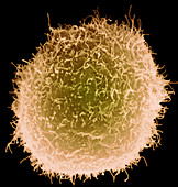 Macrophage and lymphocytes