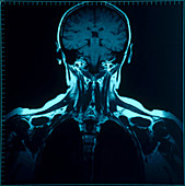 Head and torso MRI