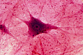 Light micrograph of a spinal cord nerve cell