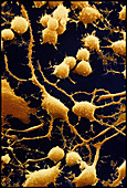 Coloured SEM of human nerve cells