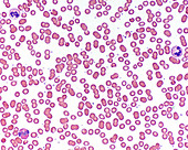 Blood smear