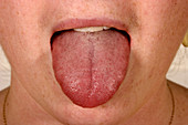 Tongue