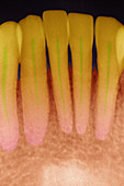 colourized dental x-ray