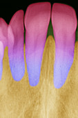 colourized dental x-ray