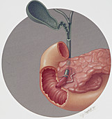 Gall bladder