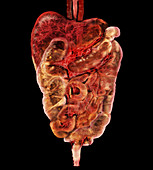 Lower Digestive Tract