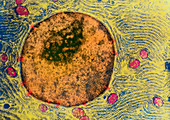 TEM of human pancreatic acinar cell