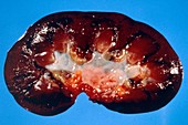 Gross specimen of normal human kidney in section