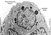 Alveolar cell