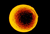 Coloured SEM of a human ovum (egg)