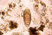 Schistosome Egg