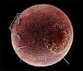 Human Sperm Fertilizing an Egg