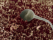 Human Spermatozoa Fertilizing an Egg